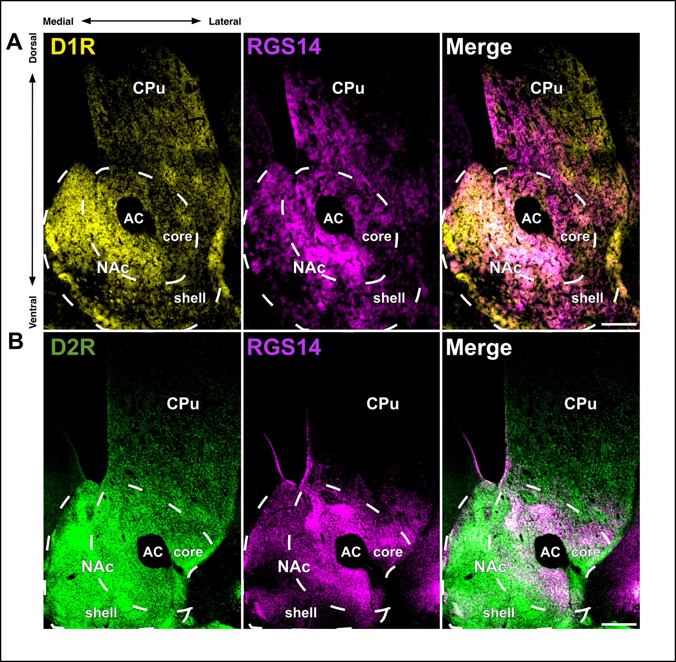 D1/D2 immunohistochemistry