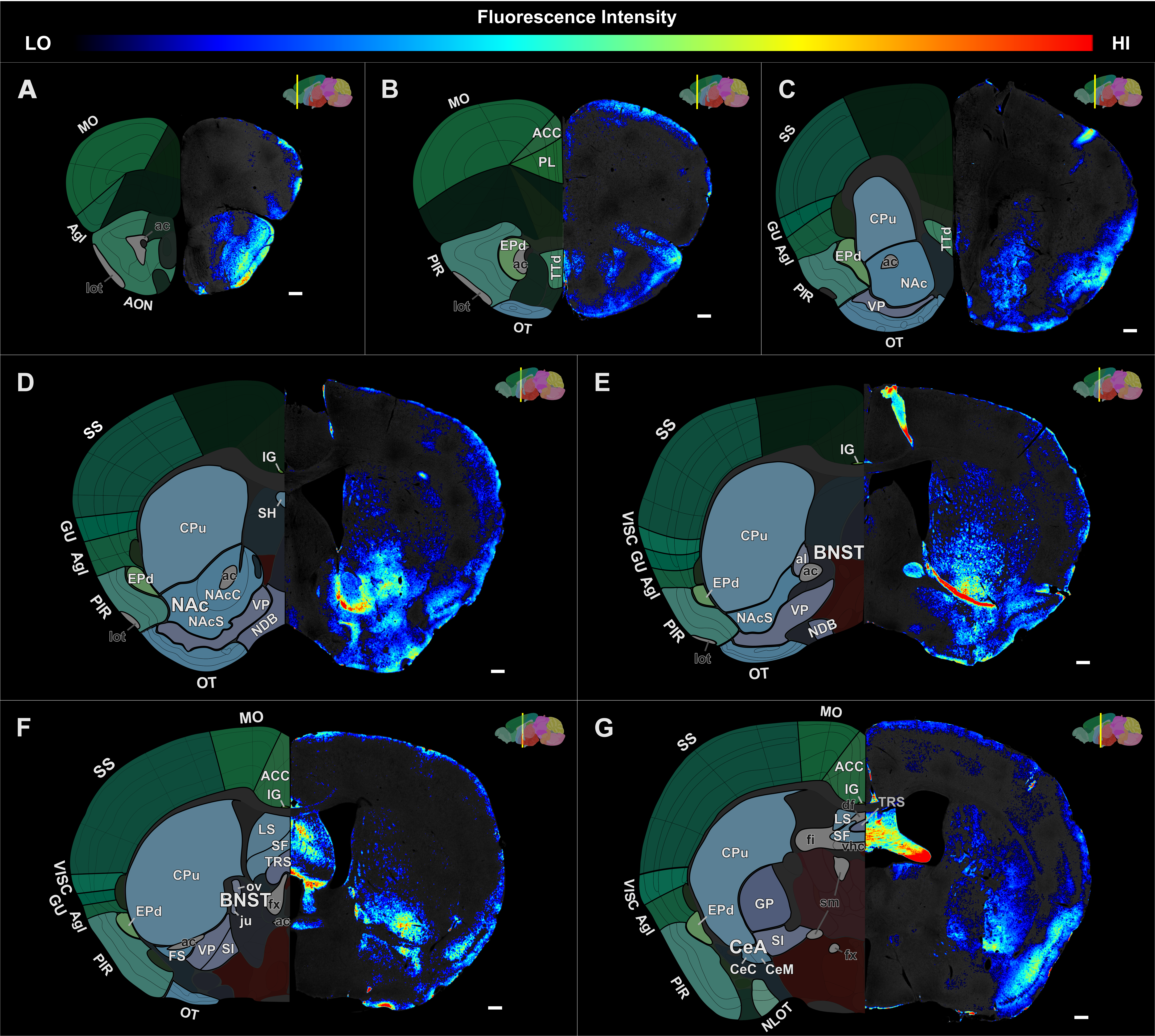 Whole-brain atlas of RGS14 immunoreactivity, anterior