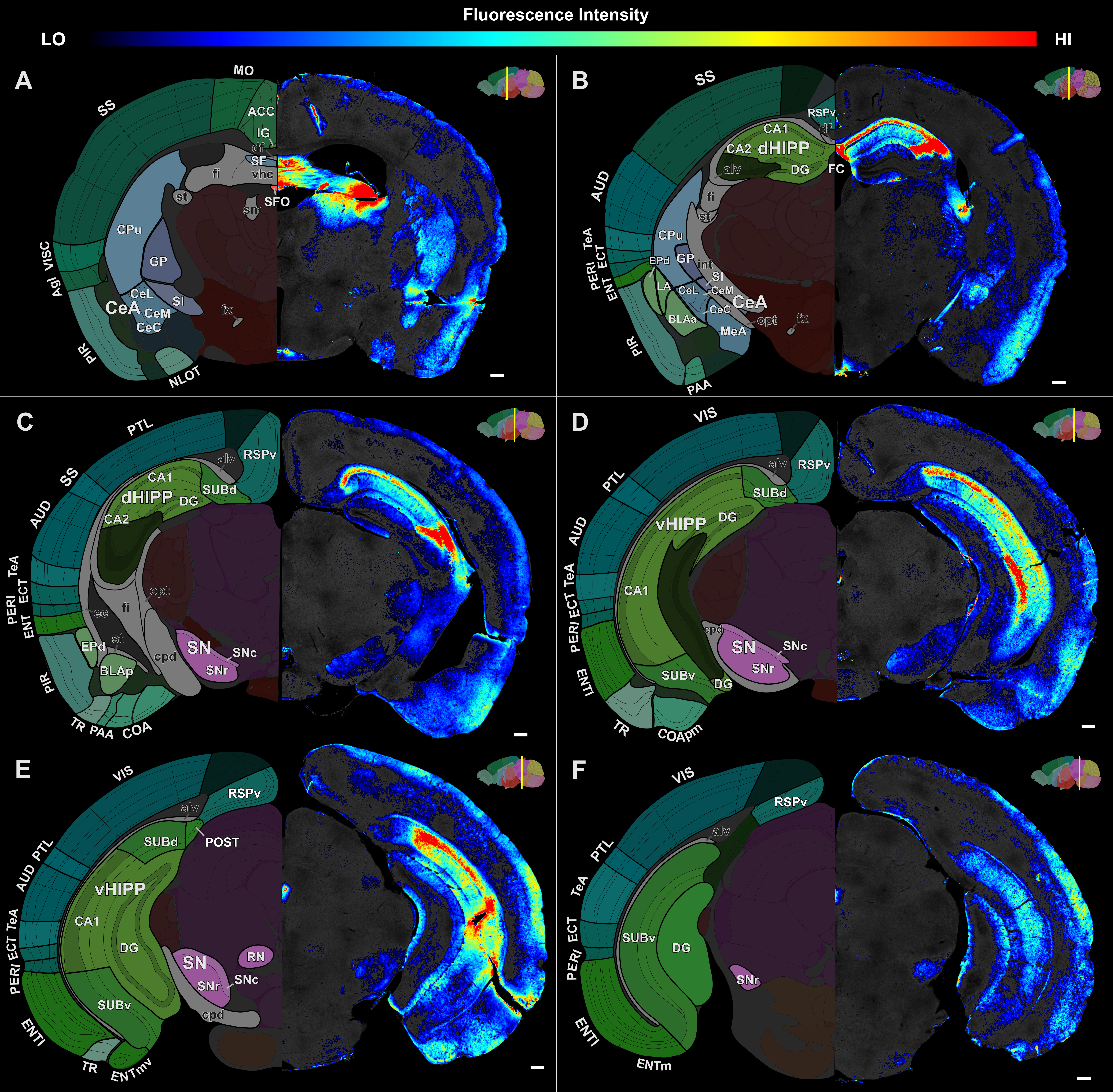 Whole-brain atlas of RGS14 immunoreactivity, posterior